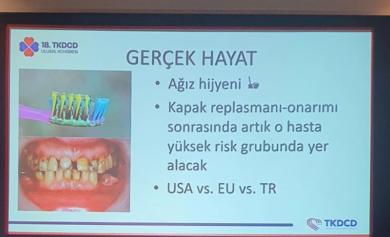 İstanbul- Bilimsel sunumda ortaya çıktı: 6 kişilik ailenin tamamı aynı diş fırçasını kullandı